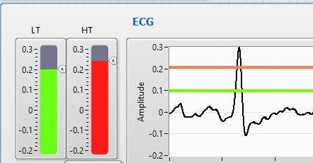 DIY ECG Using an Analog Discovery 2 and LabVIEW – Digilent Blog