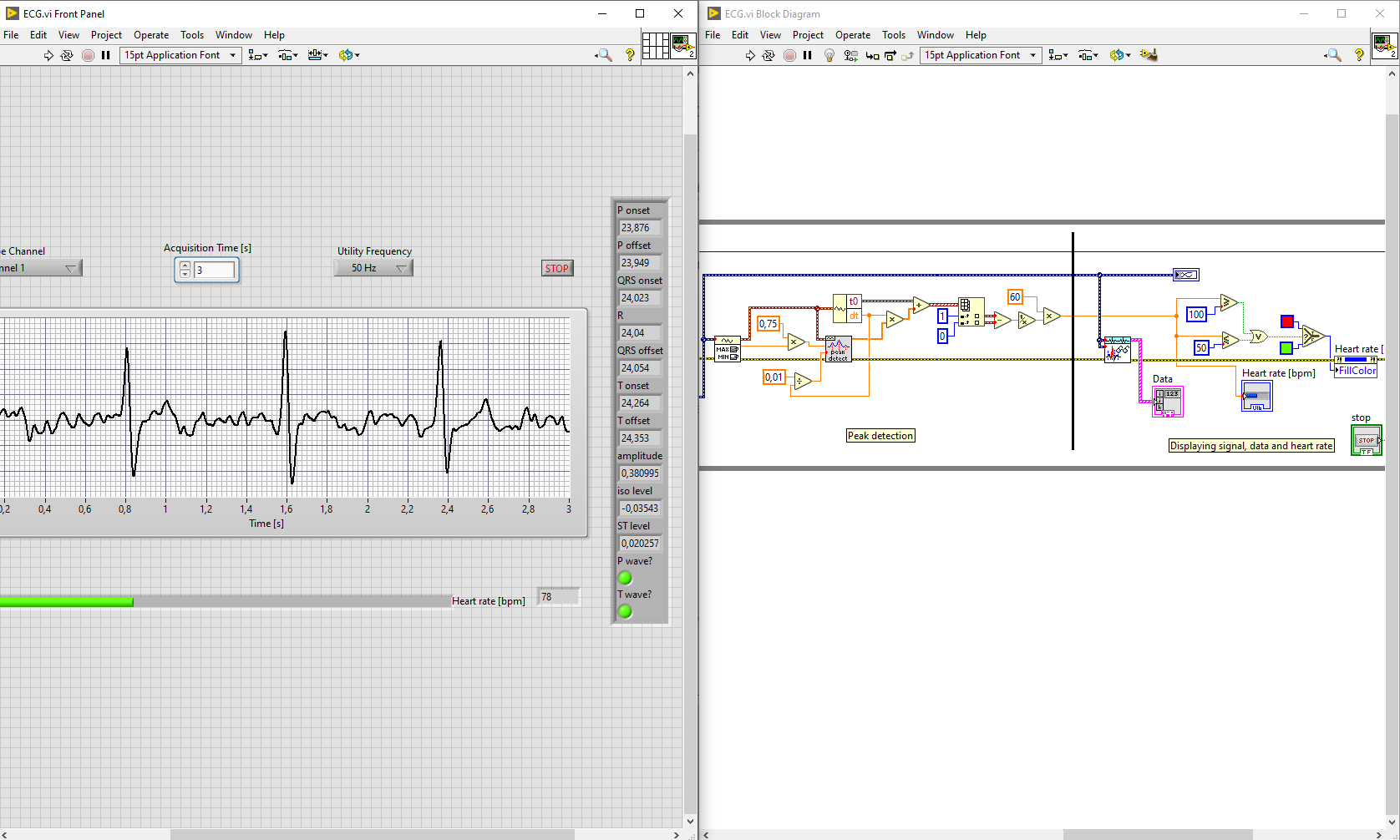 Tighten you are Decode DIY ECG With Analog Discovery Studio and LabVIEW - Digilent Reference